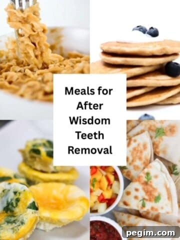 Four images of food with text in the center, "Meals for After Wisdom Teeth Removal."
